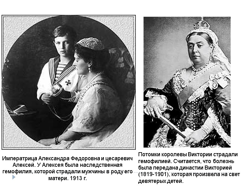 Потомки королевы Виктории страдали гемофилией. Считается, что болезнь была передана династии Викторией (1819-1901), которая